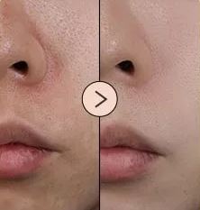 EQUALBERRY Vitamin Illuminating Serum